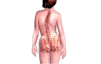 Razón el desarrollo de la osteocondrosis cervical