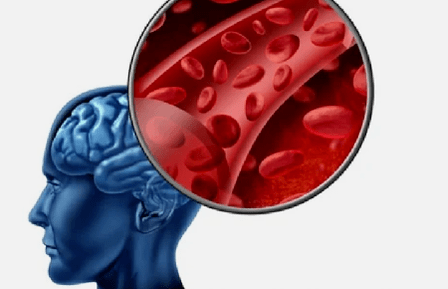 Síntomas de osteocondrosis espinal cervical