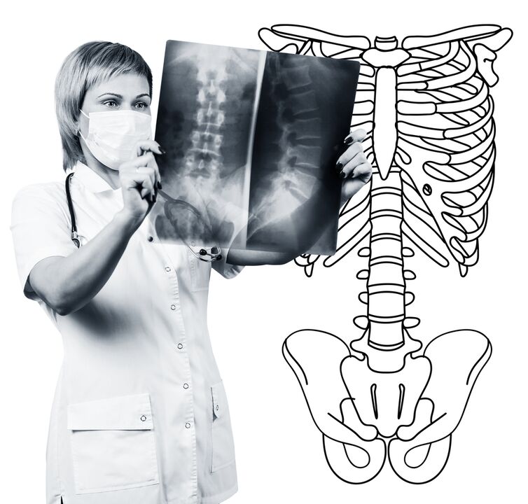 Radiografía de columna lumbar